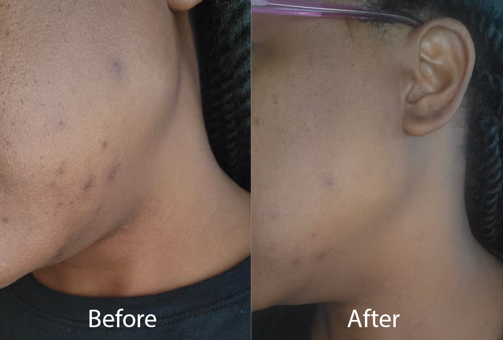 best dark spot correctors
