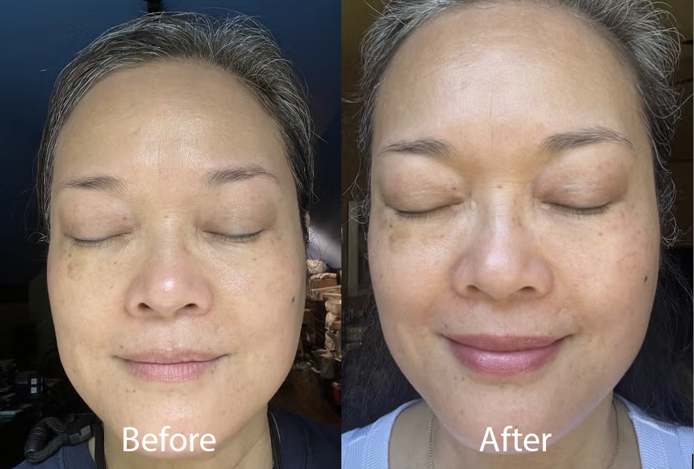 best dark spot correctors