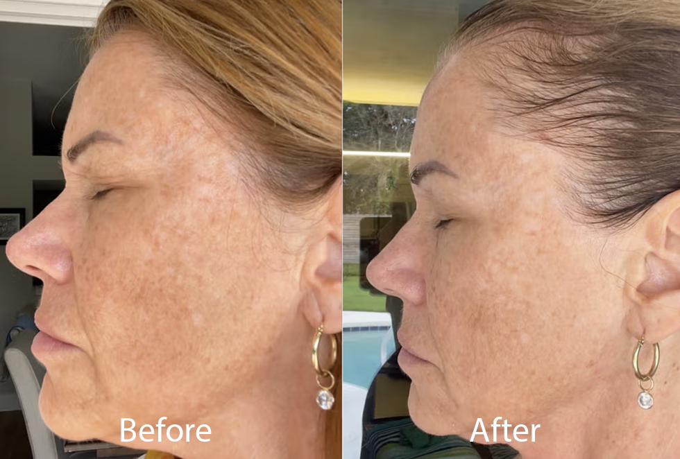 best dark spot correctors