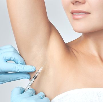 the doctor makes intramuscular injections of botulinum toxin in the underarm area against hyperhidrosis cosmetology skin care