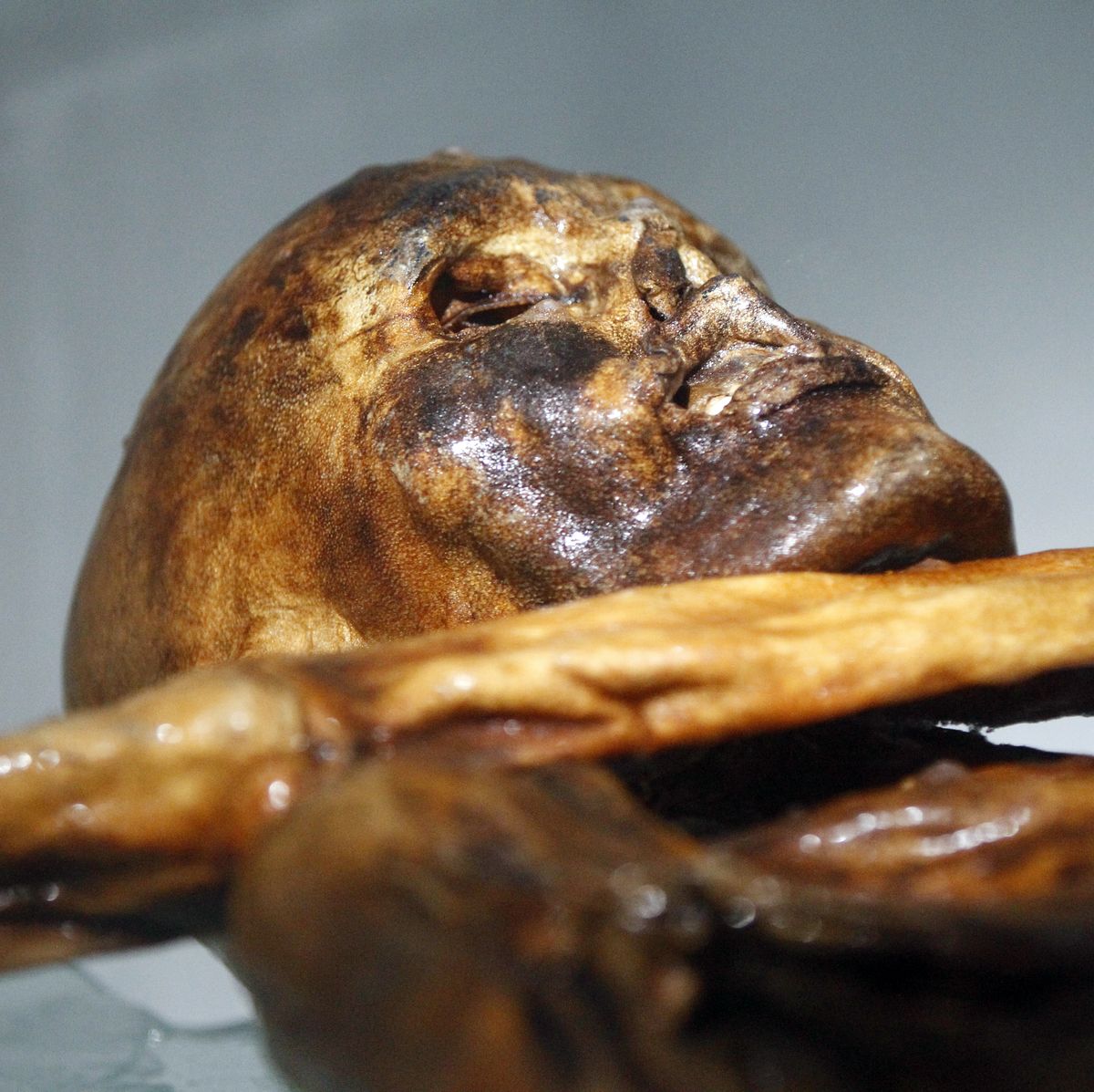 5,000-Year-Old Mummified Iceman Revealed As Balding Farmer