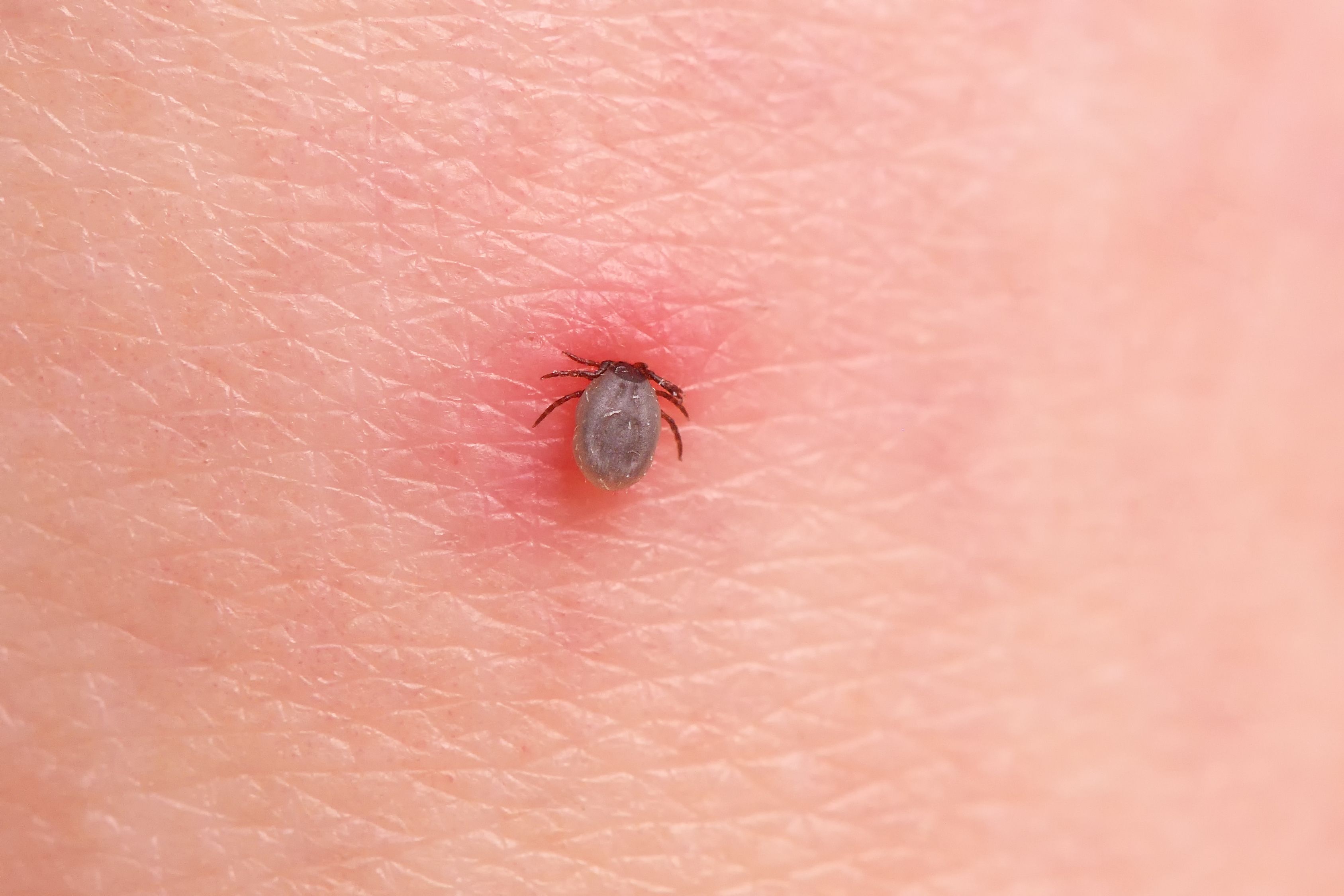 tick-bite-pictures-symptoms-what-does-a-tick-bite-look-like