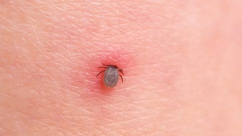 preview for How to Prevent and Take Care of Tick Bites