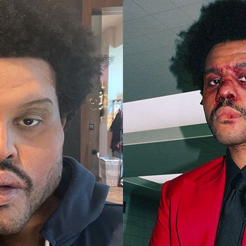 The Weeknd's face freaks some people out