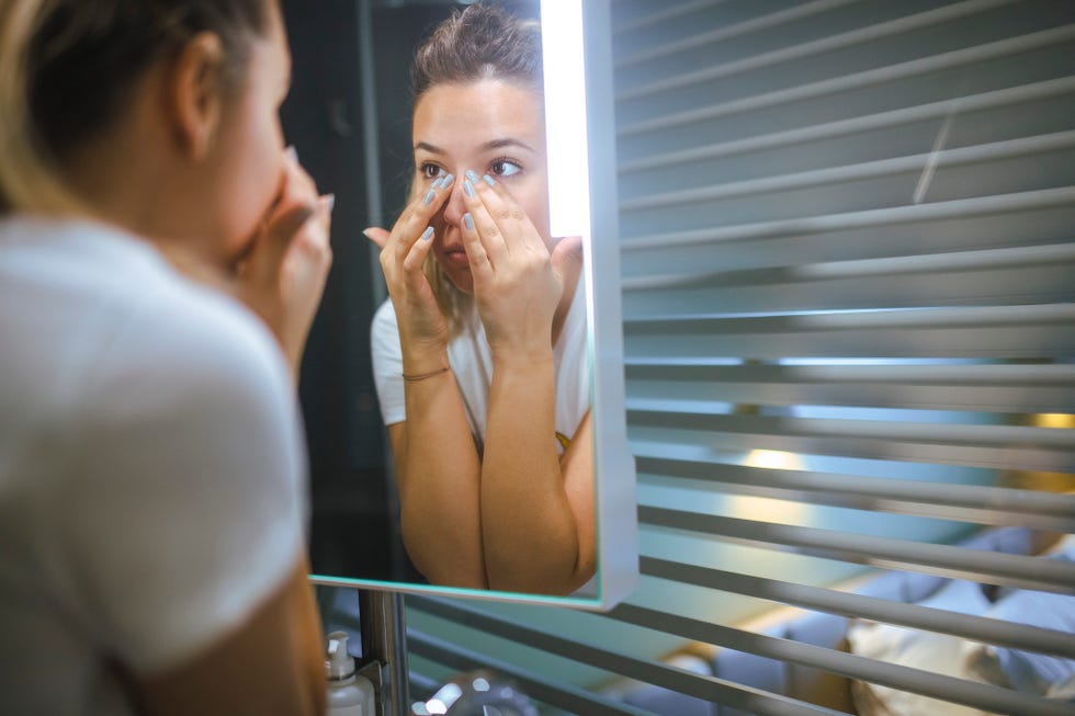 ojeras moradas por qué aparecen y cómo eliminarlas