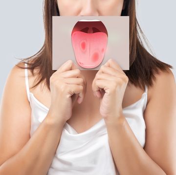the woman show the picture of tongue problems