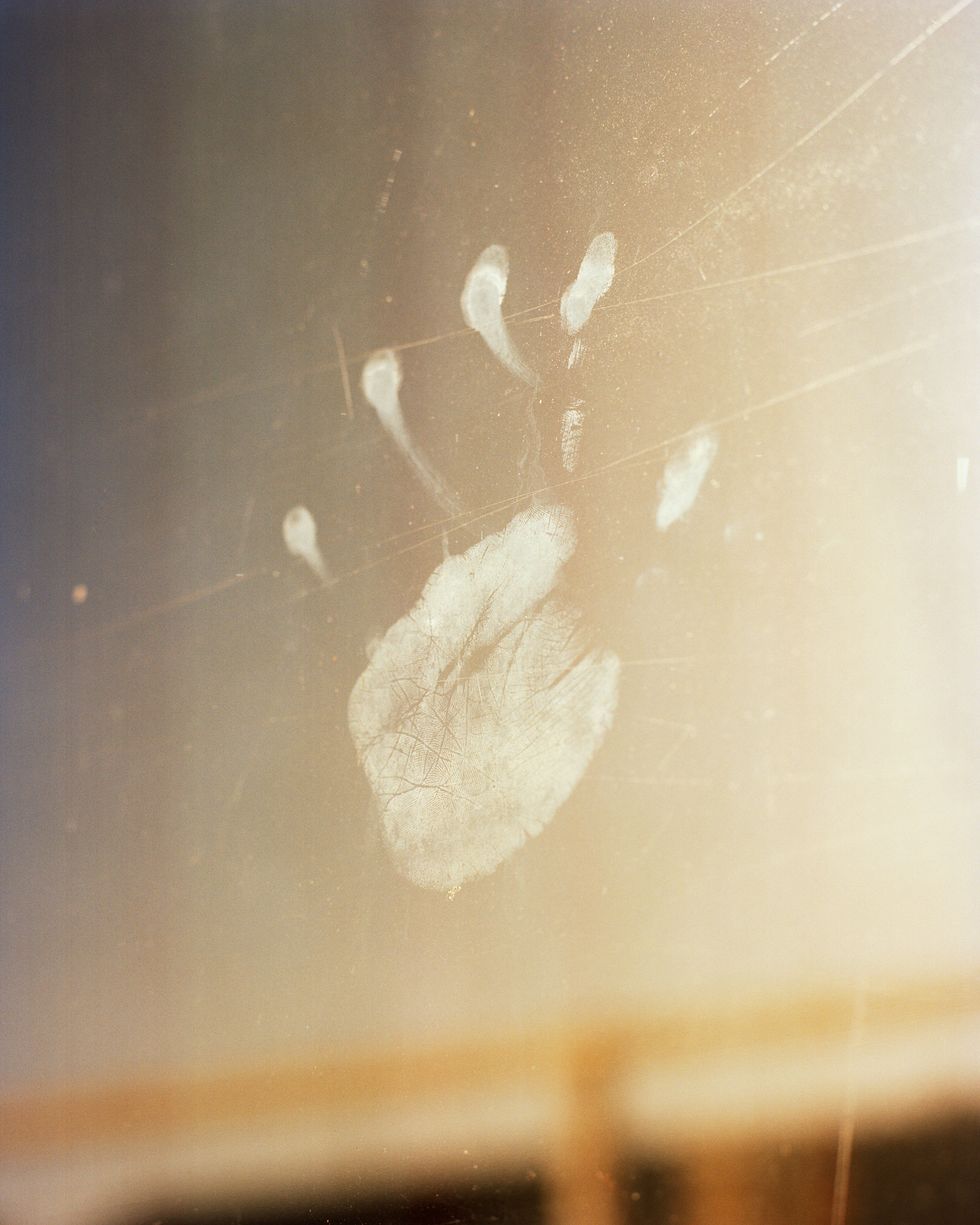 a child’s handprint on a hospital window