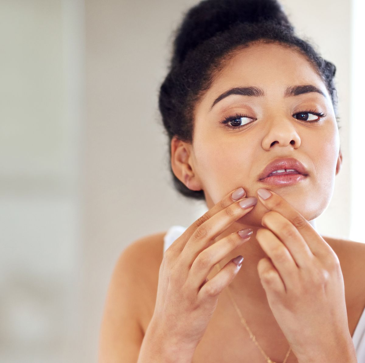 5 Different Types of Skin Blemishes on The Face And Its Treatments