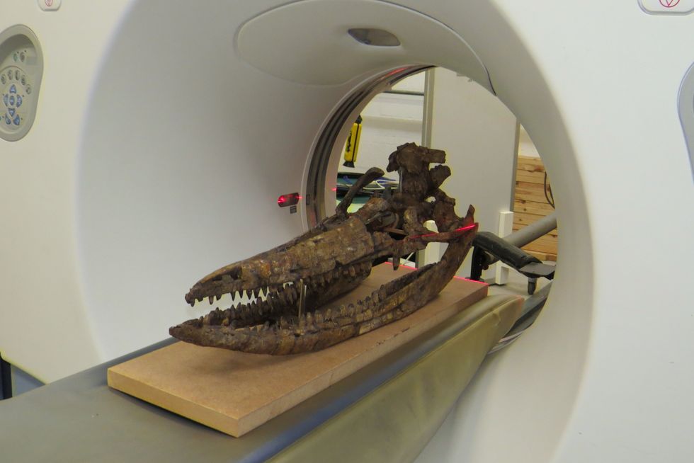 university of manchester skull ct scan