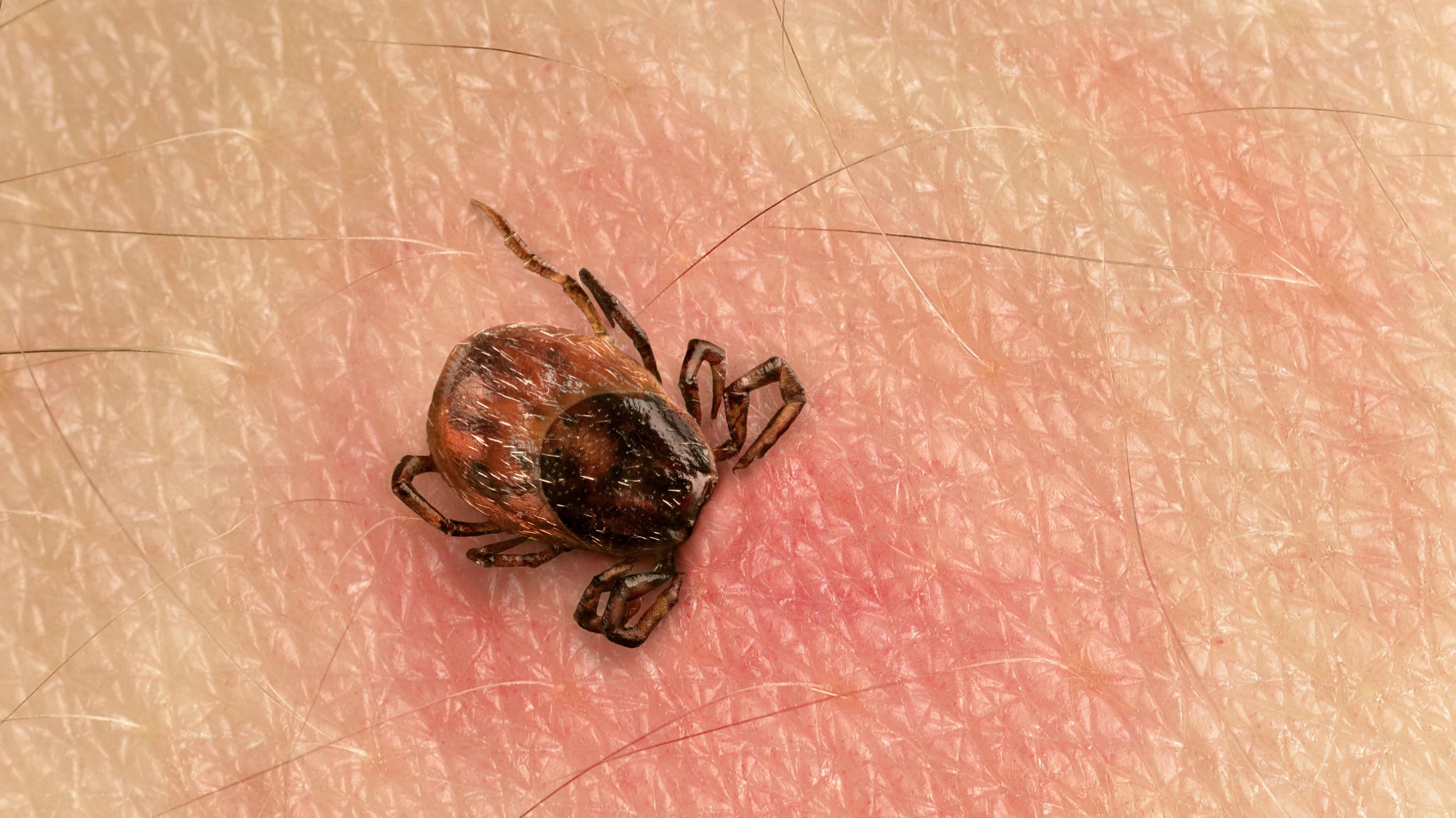 Tick Bite Pictures & Symptoms - What Does a Tick Bite Look Like?