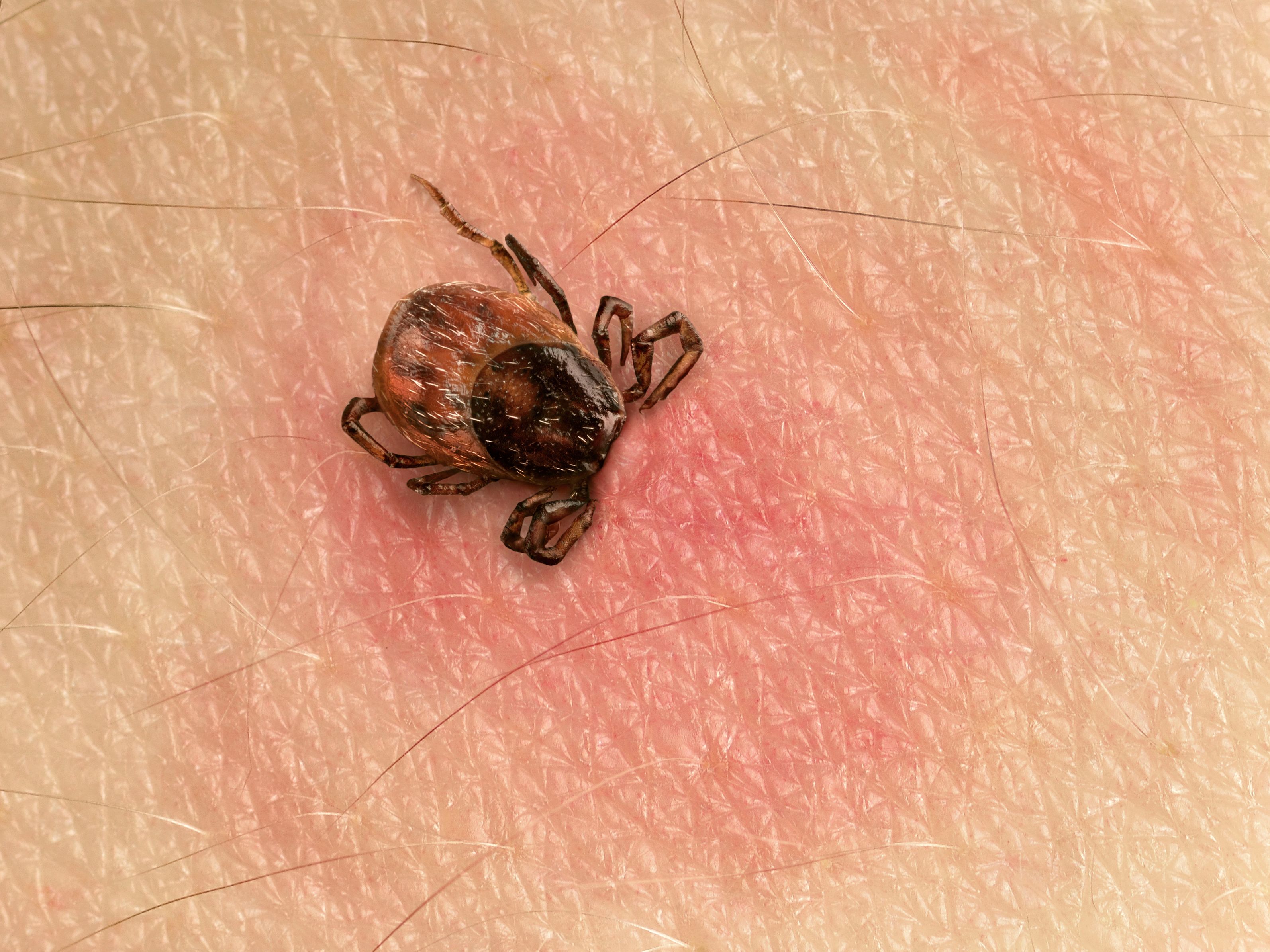 can ticks jump from dogs to humans