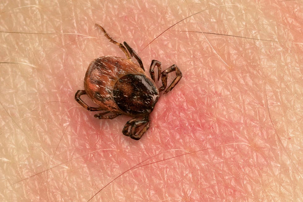 Tick bite