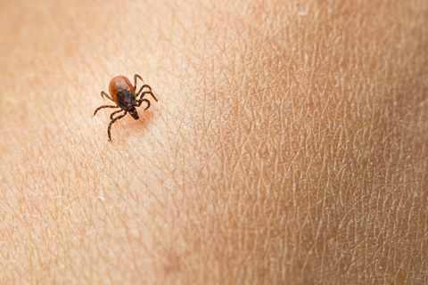 Tick parasit on a human skin