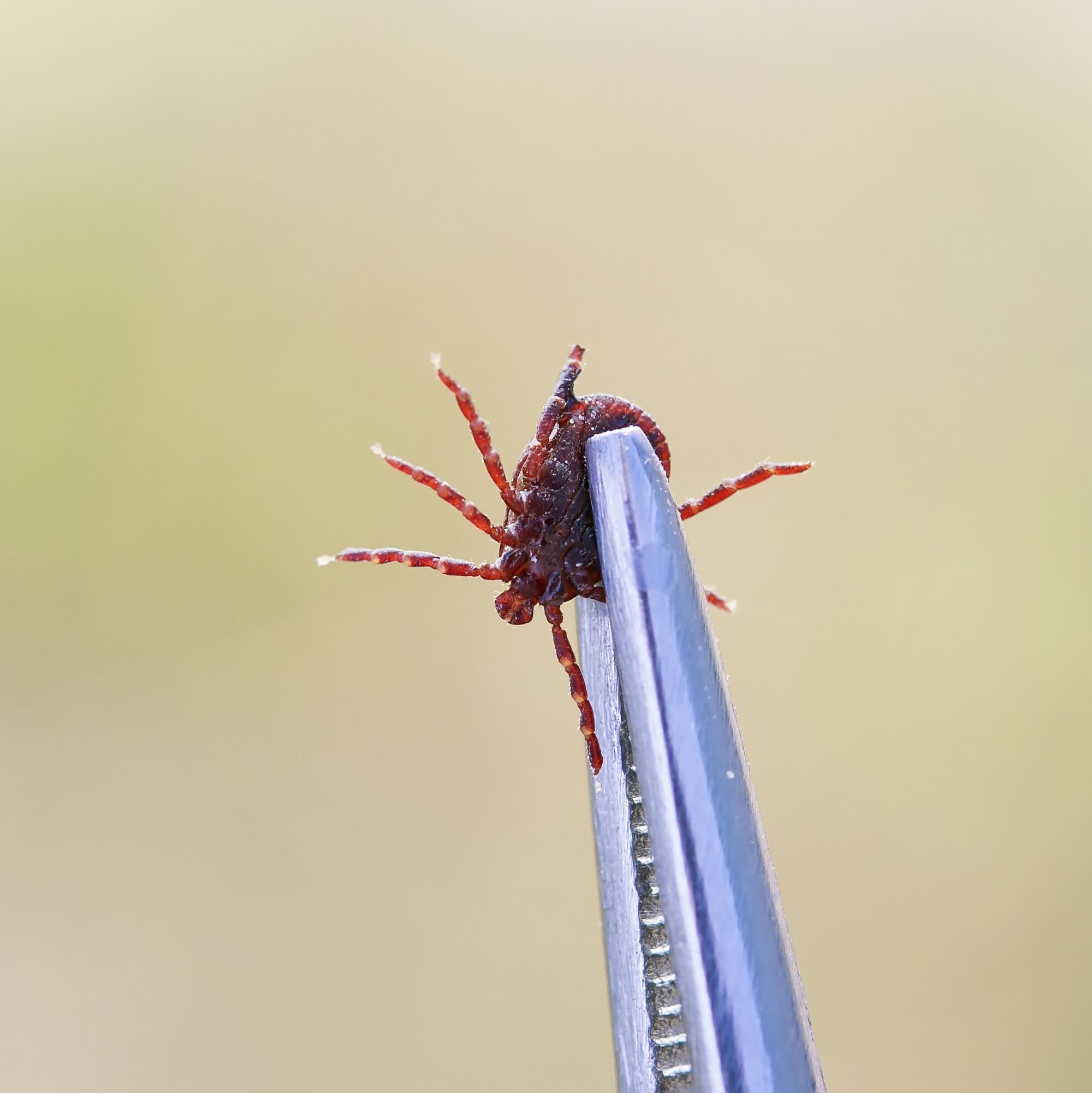 How To Remove A Tick The Right Way According To Doctors   Tick Tweezers 1555513069 