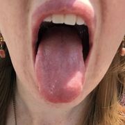 tongue health tips