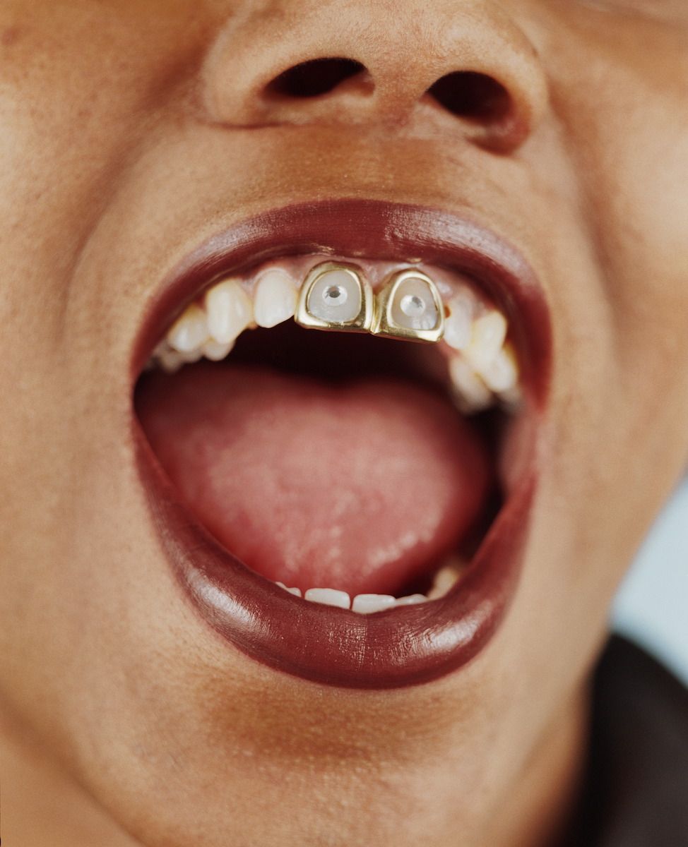 Brillantini sui denti e tooth gems, la nuova mania delle star Foto 6
