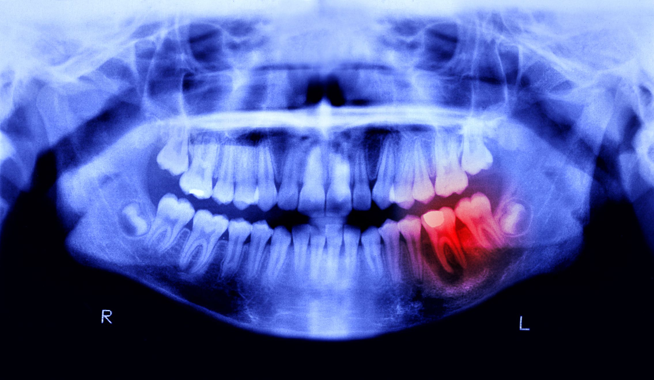 Humans May Be Able to Grow New Teeth Within Just 6 Years