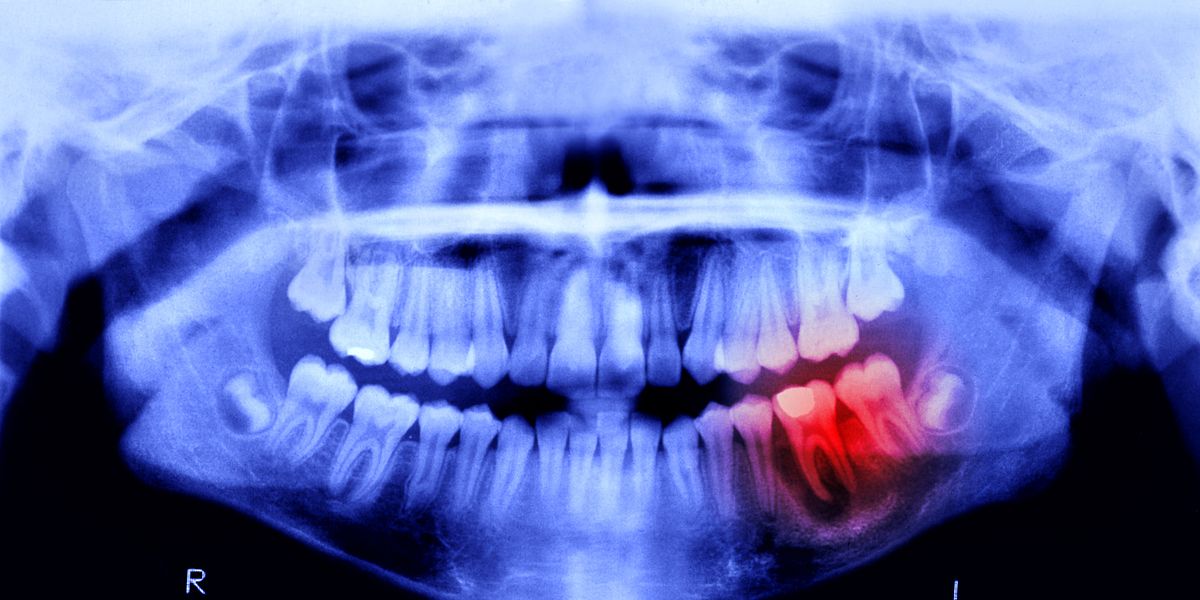 人間はわずか6年で新しい歯が成長する可能性があります