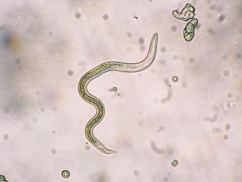 Toxocara canis second stage larvae hatch from eggs