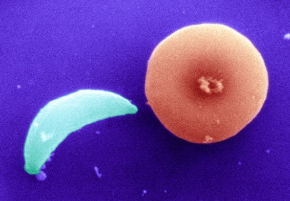 Toxoplasma Gondii