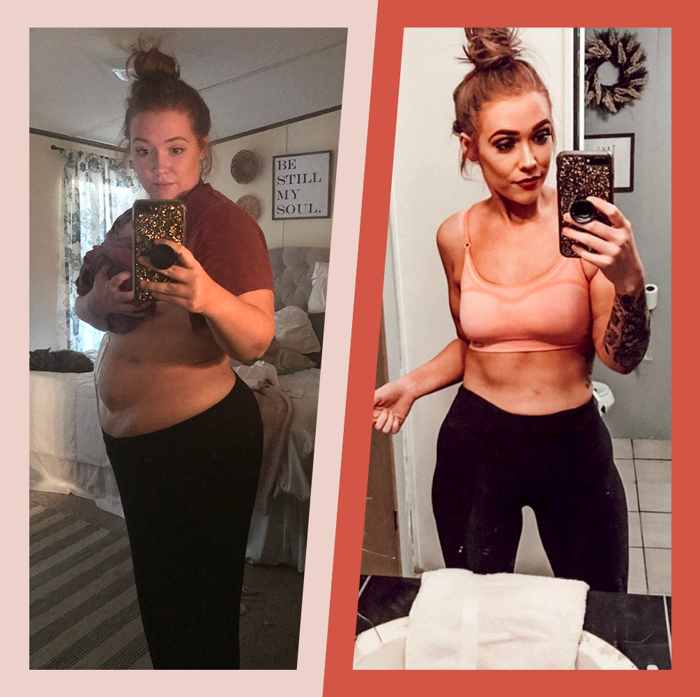 Allyssa Has Life Back After Gastric Sleeve Surgery