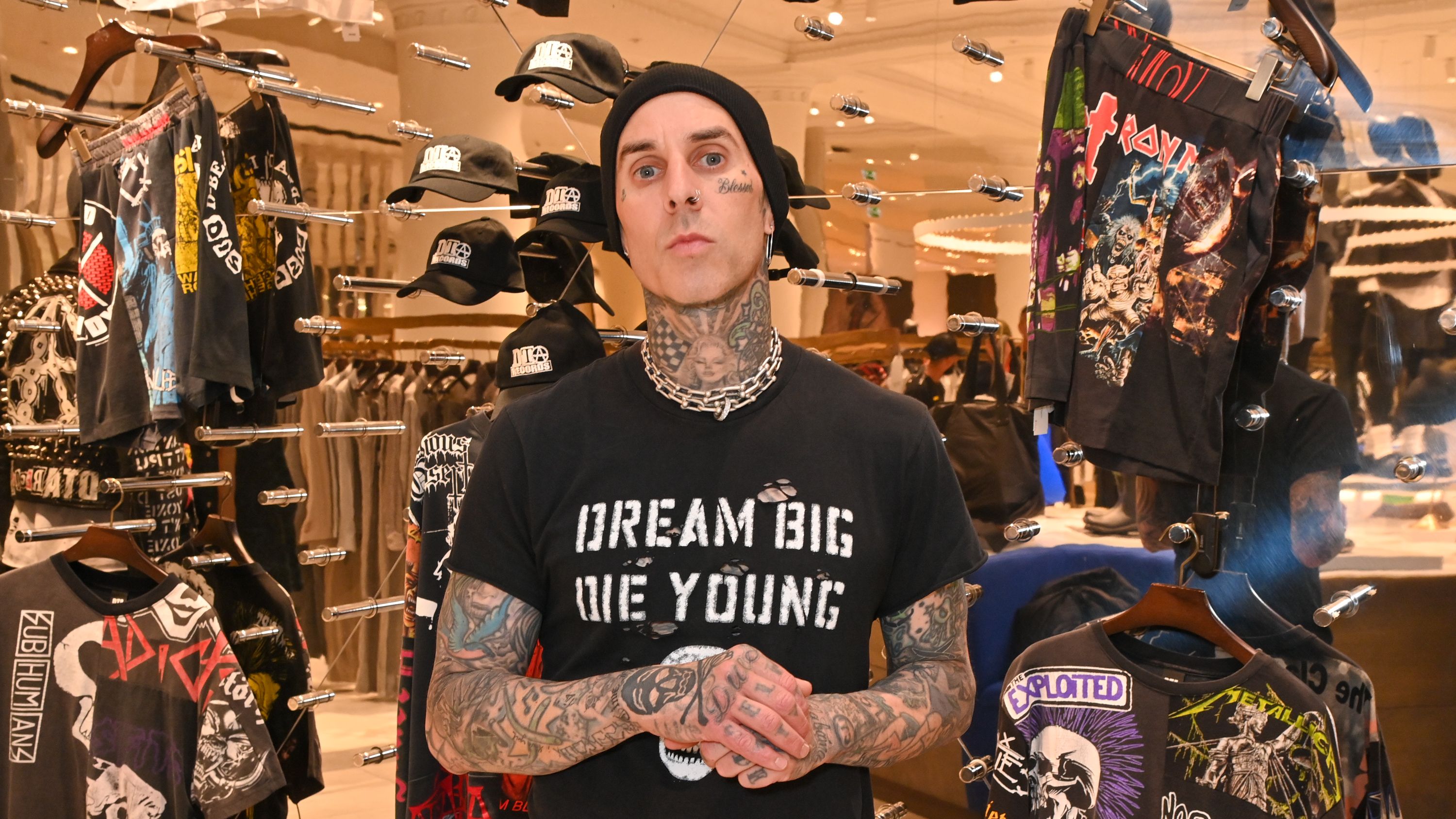 Travis Barker Shows Off His Gory Hand Injury After Blink-182 Gig