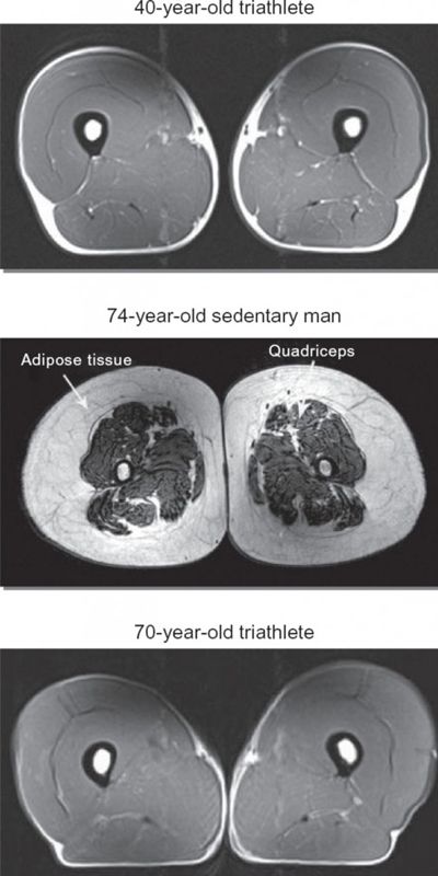 肌肉剖面圖; 上：40歲三鐵選手。中：74歲坐式生活（少動）。下：70歲三鐵選手