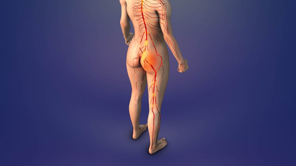 trigger point for sciatica in human glutes