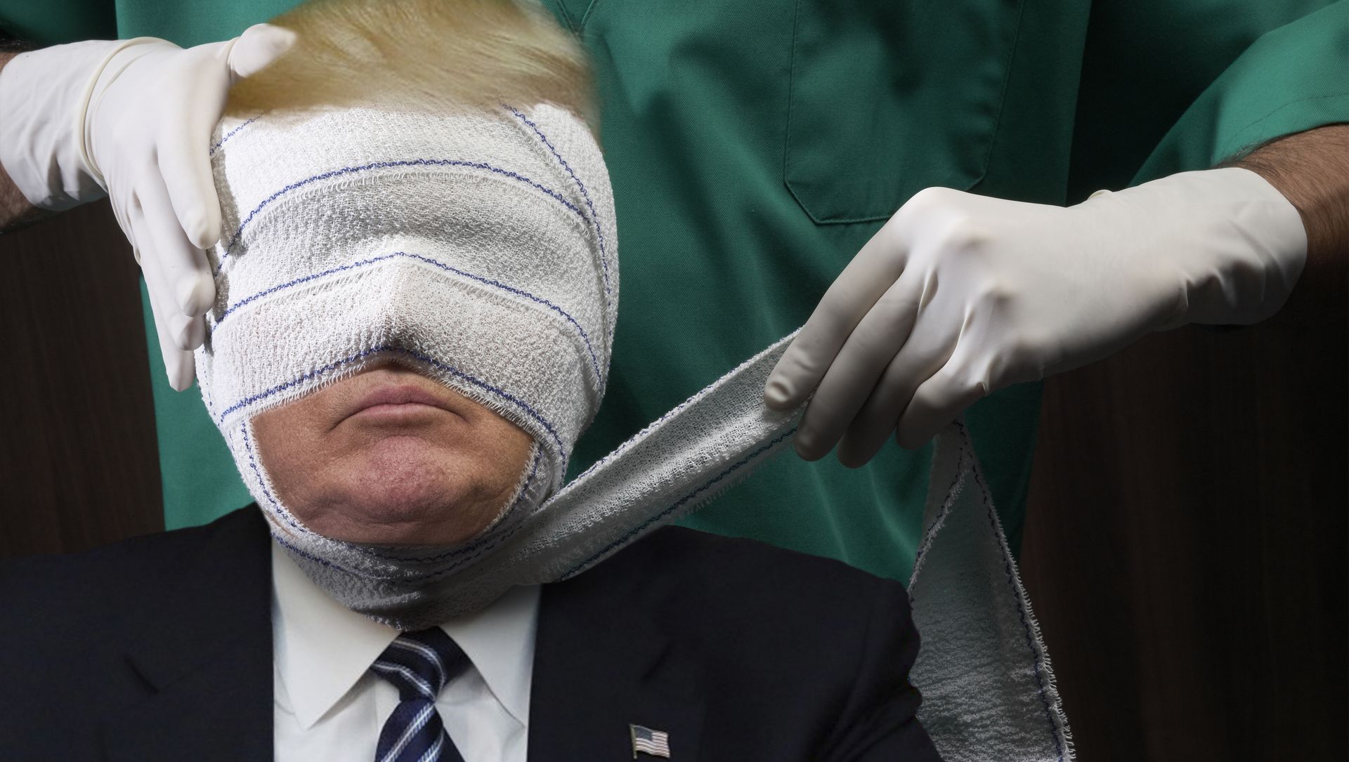 Donald Trump plastic surgery