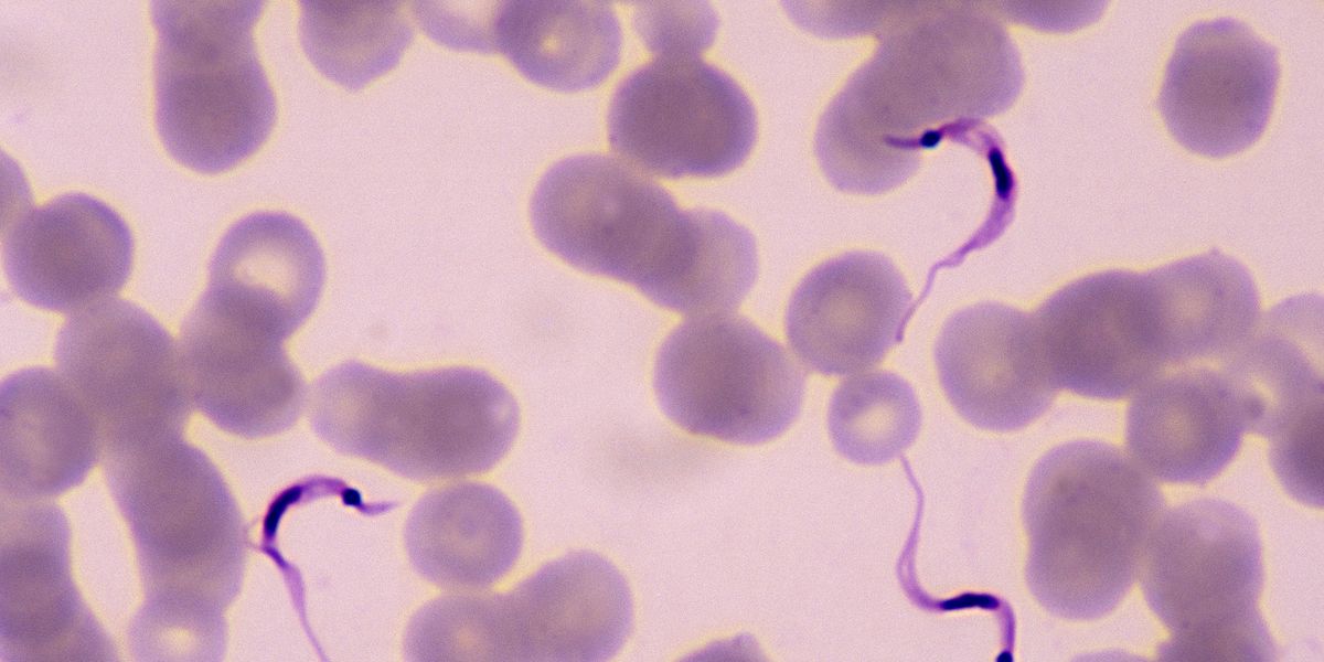Deadly ‘Kissing Bug’ Disease Chagas Has Spread to These 32 States