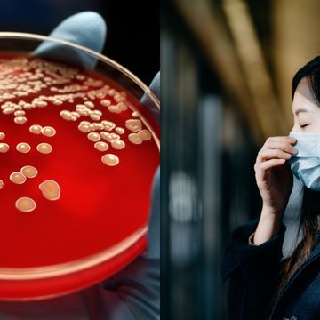 日本食人菌是什麼？a型鏈球菌感染導致毒性休克症候群，症狀有哪些、如何預防一次看