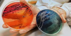 nordx labs in scarborough offers a wide variety of testing services including microbiological testin