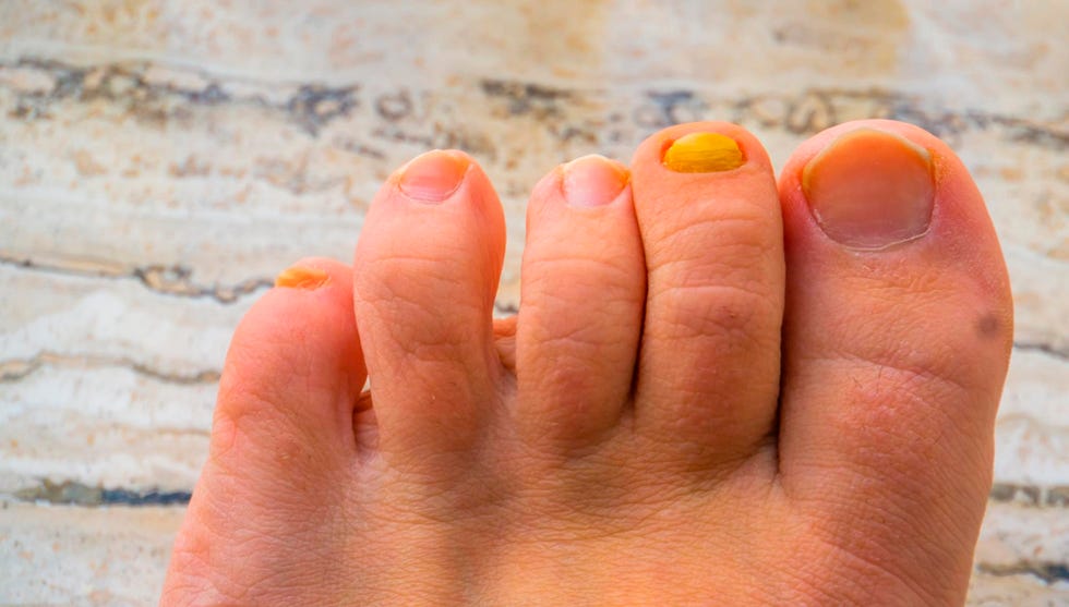 a pair of feet with painted toenails