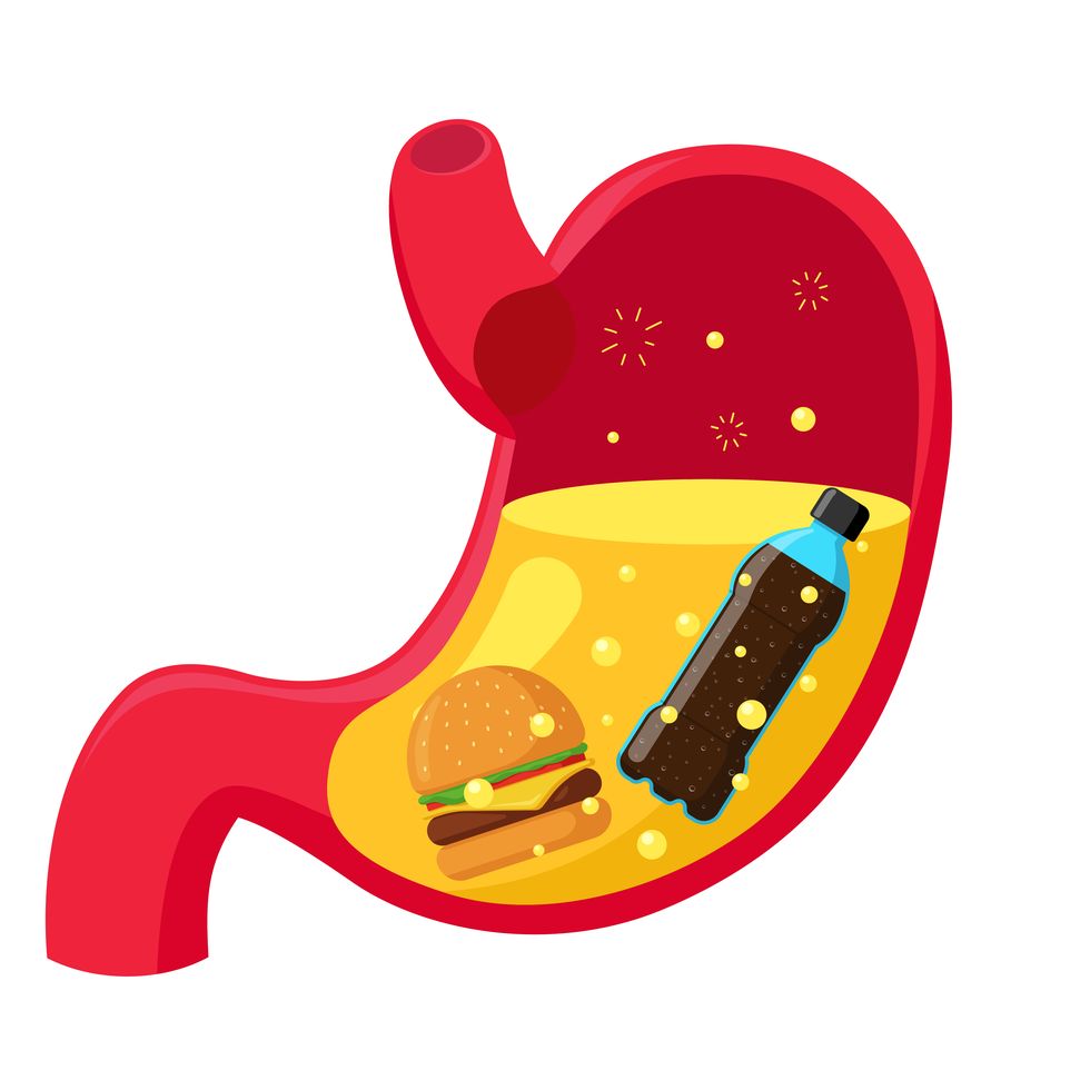 unhealthy eating fast food burger soda and gastric juice in stomach human digestive system organ indigestion problems vector illustration