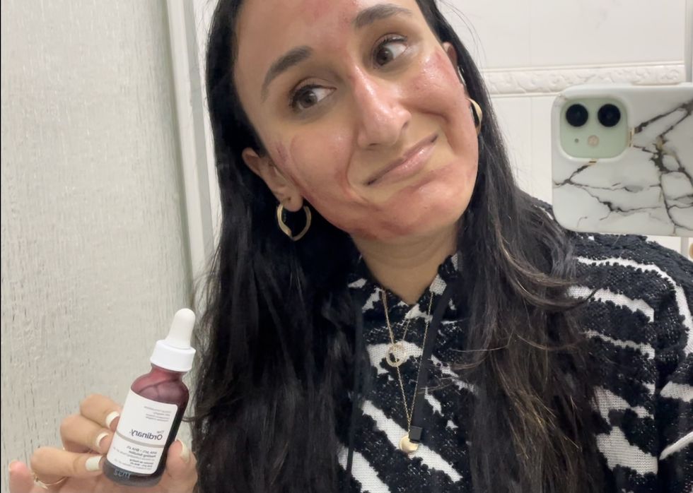 the ordinary peeling solution review