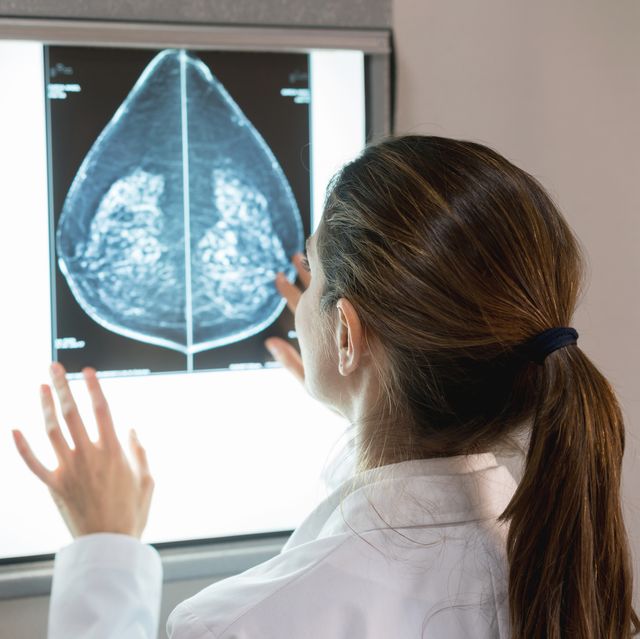 unrecognizable female gynocologist looking at a mammogram at the hospital