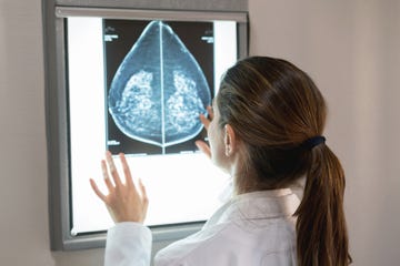 unrecognizable female gynocologist looking at a mammogram at the hospital