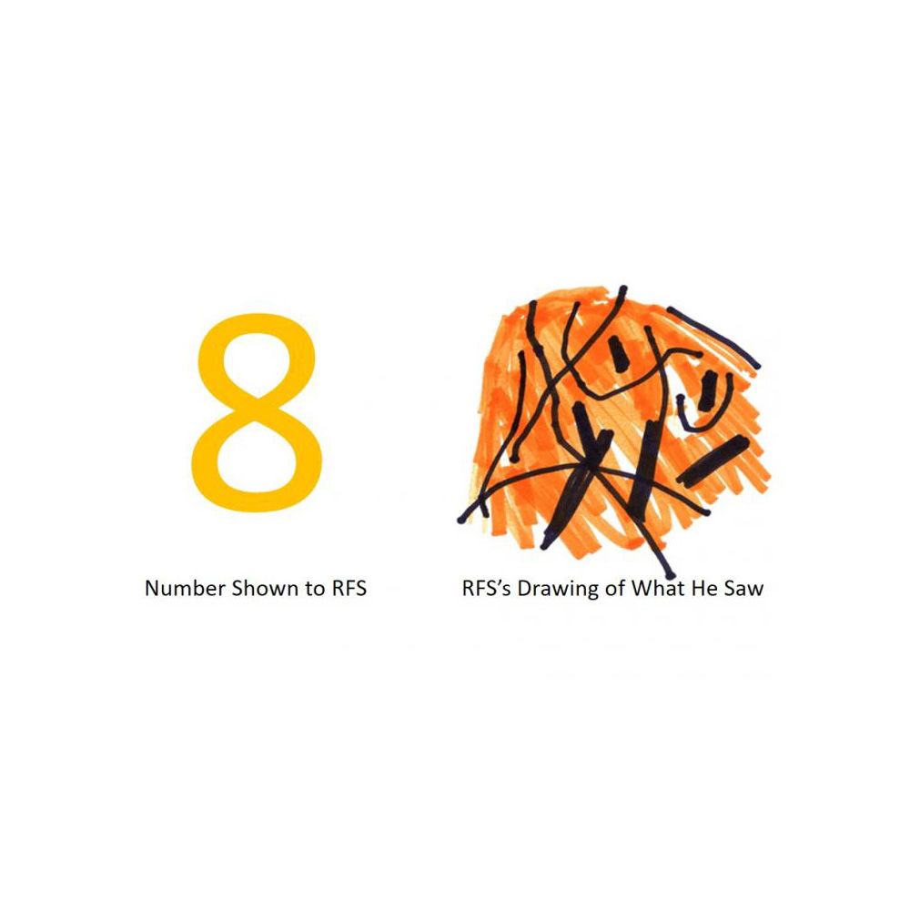 on the left, the number 8, which was shown to the patient on the right, an orange scribble with black abstract lines, which is what the patient perceived