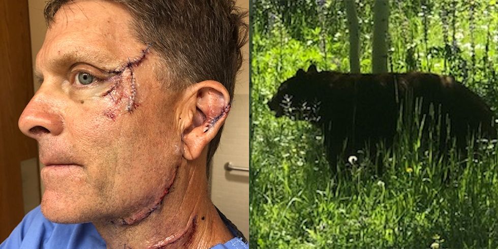 Navy Vet's Jaw Torn Off After Being Attacked by Bear