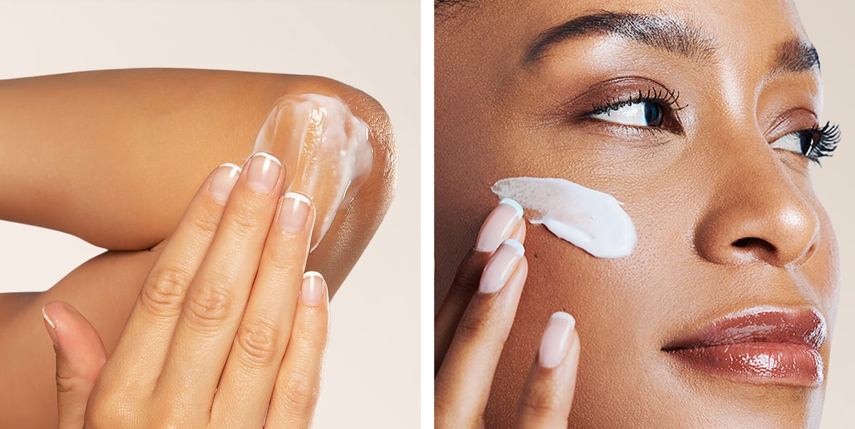 Dermatologists Swear by These Eczema Creams for Instant Relief