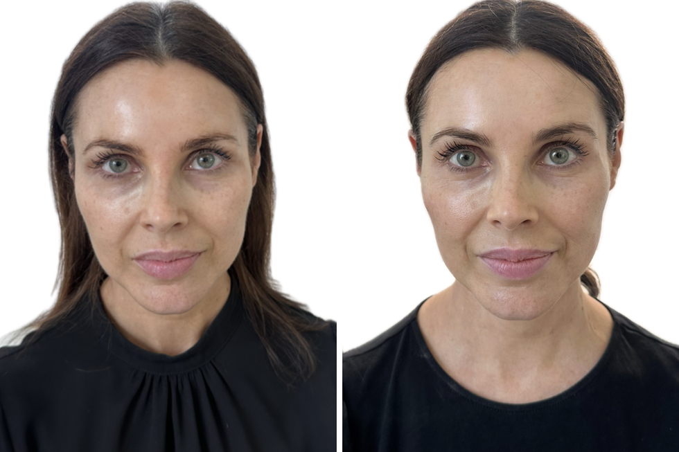 jennifer aniston salmon sperm facial review