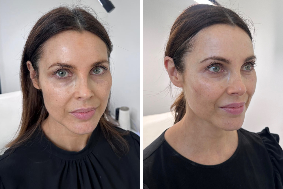 jennifer aniston salmon sperm facial review