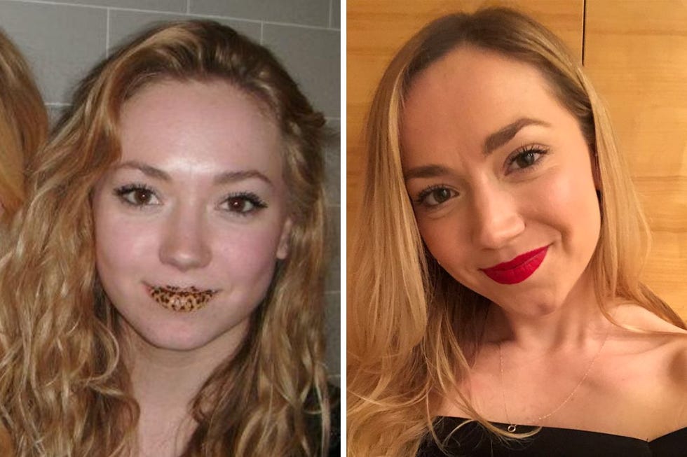 worst teenage beauty disasters