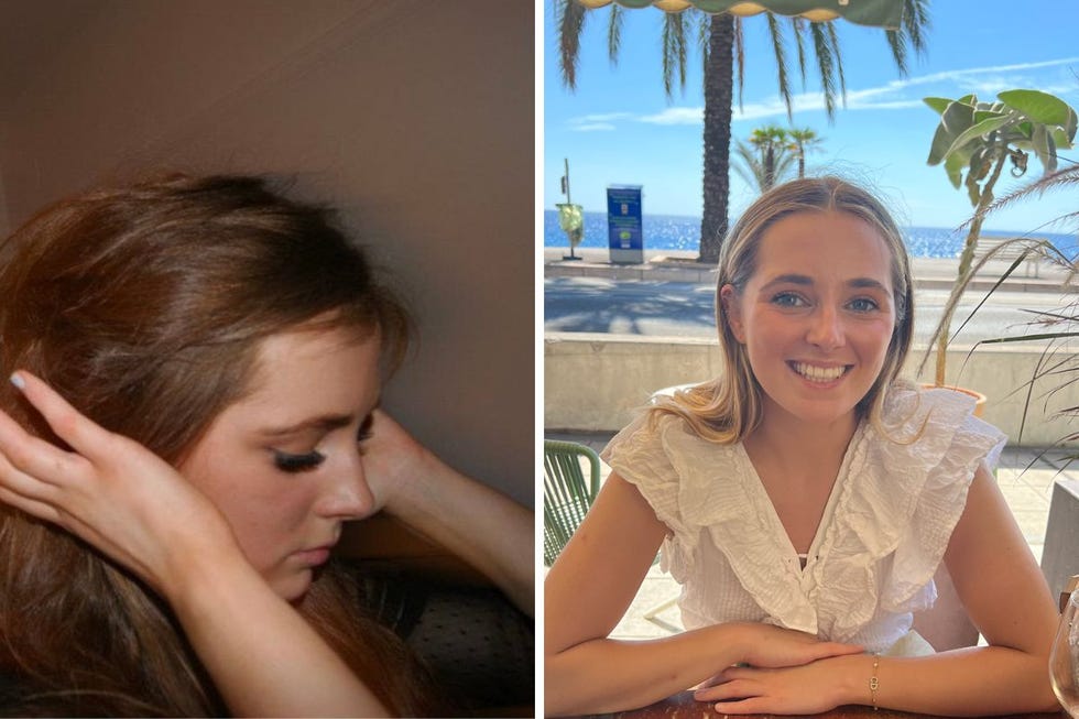 worst teenage beauty mistakes