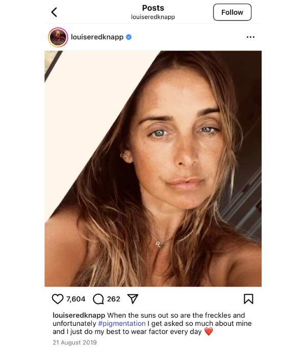 louise redknapp pigmentation serum