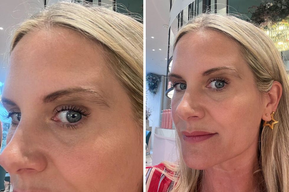 microblading thin overplucked brows