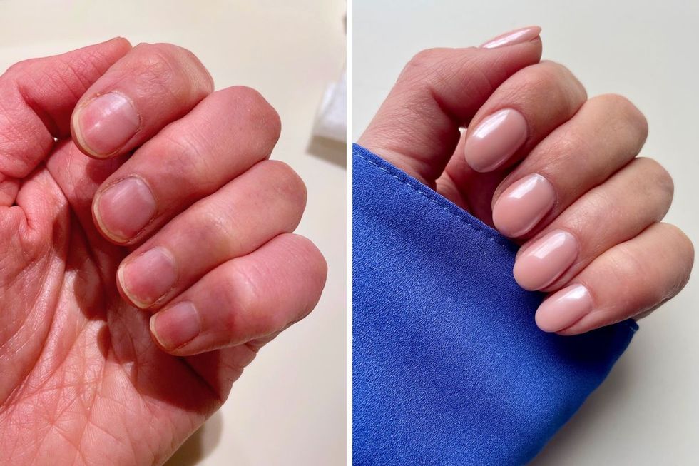 before and after biab nails