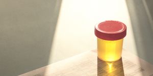 urinalysis, drug testing, drug plastic jars for medical tests urine test