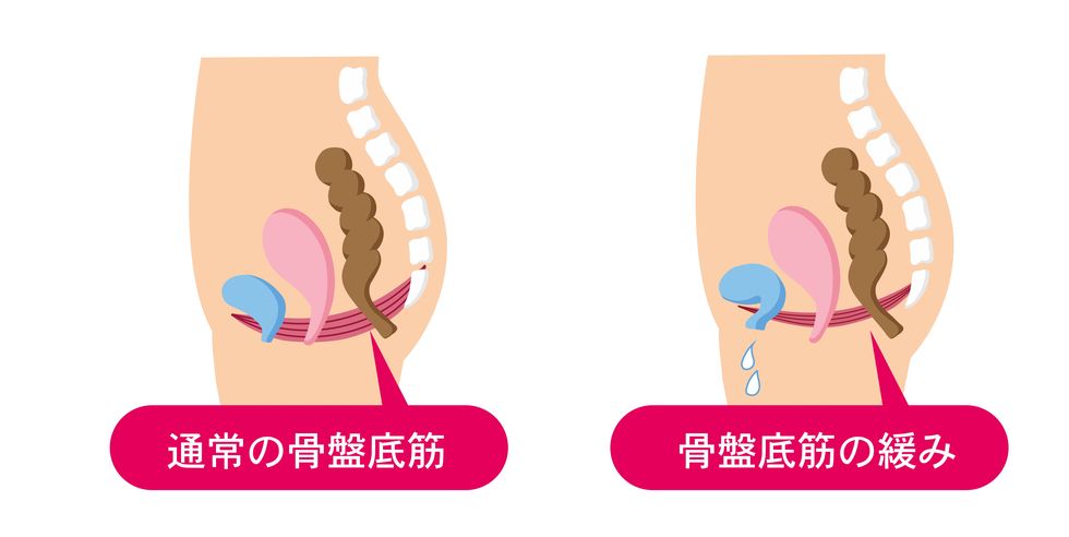 urine leakage mechanism medical illustration of pelvic floor muscles