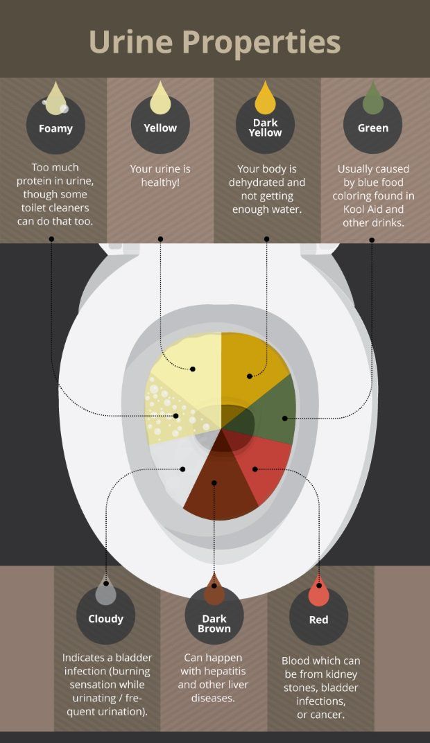 Urine Properties infographic